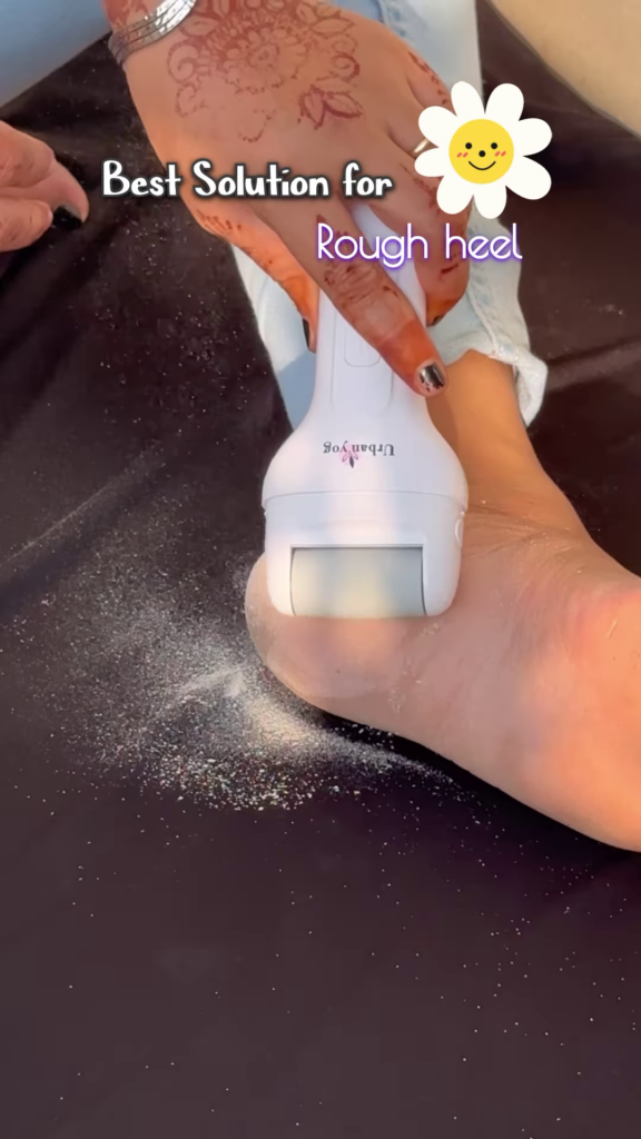 Electric Foot Callus Remover with Roller Head for Smooth Feet - Photo 3
