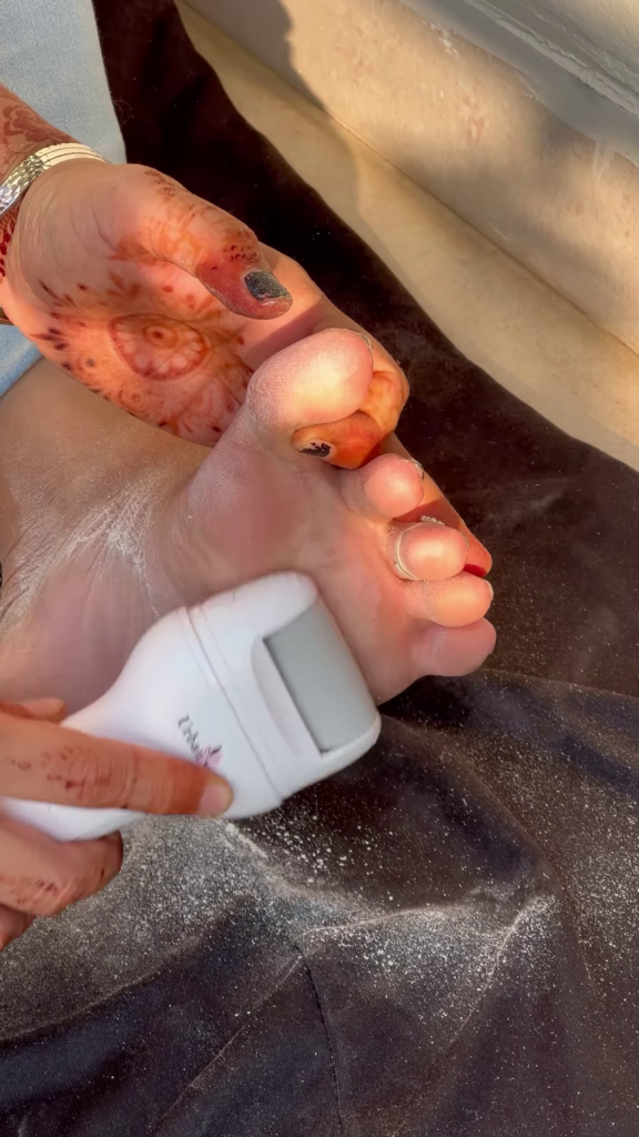 Electric Foot Callus Remover with Roller Head for Smooth Feet - Photo 4